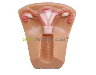 GPI/1013女性盆腔器官模型