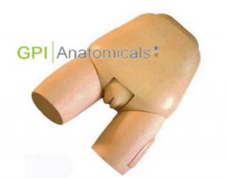 GPI/F31高級子宮底檢查評定模型