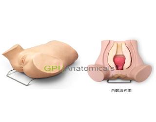 GPI/F83103診斷性刮宮監測考核指導模型