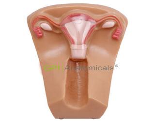 GPI/1013女性盆腔器官模型