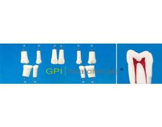 GPI/ A12A-500單直根帶髓腔恒牙
