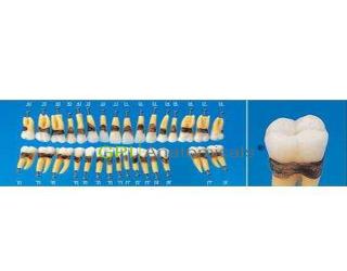 GPI/B1A-901C解剖學單根模型牙
