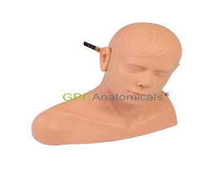 GPI/1017耳診斷模型