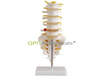 GPI/A11109腰椎模型