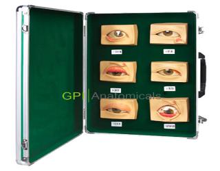 GPI/A17110常見眼病模型（20只/套）