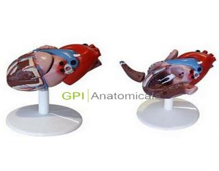 GPI/A16025心臟解剖附病態動脈血管模型