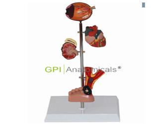 GPI/A16015糖尿病病理模型