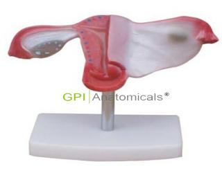GPI/A15109自然大子宮模型
