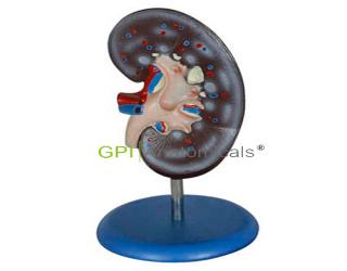 GPI/A14005腎解剖模型1件
