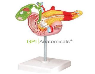 GPI/A12005病理模型胰腺模型，十二指腸和膽囊模型