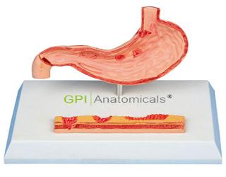 GPI/A12003病態胃模型