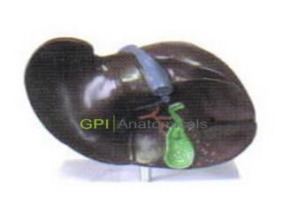 GPI/A16006肝膽結石模型