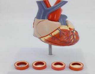 “康為醫療”病態血管心臟演示模型